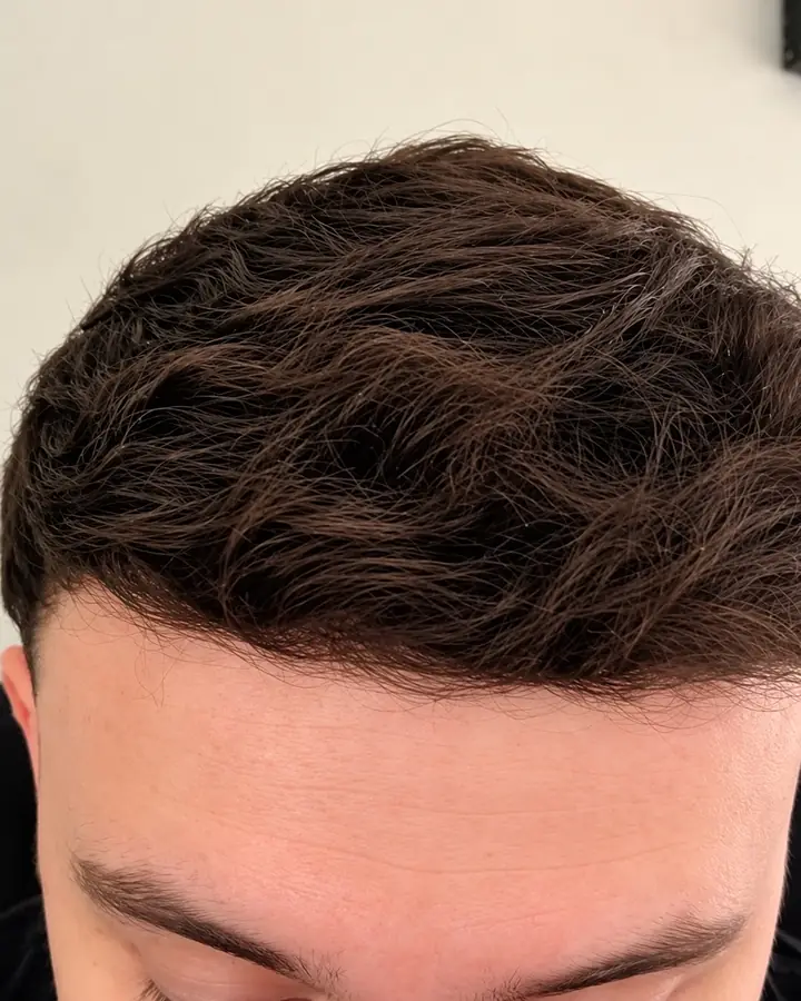 Crown, after the transplant